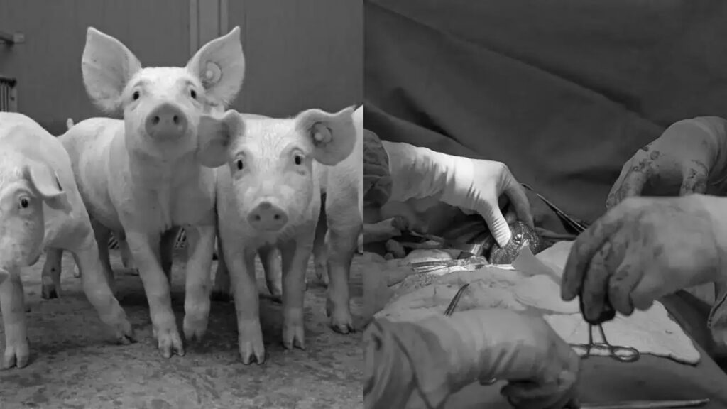 pig-to-human liver transplant