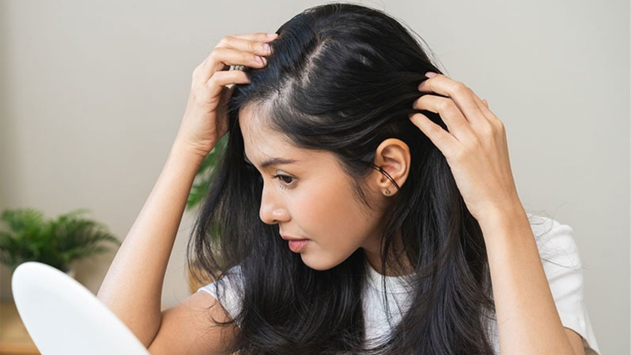Dandruff Home Remedie