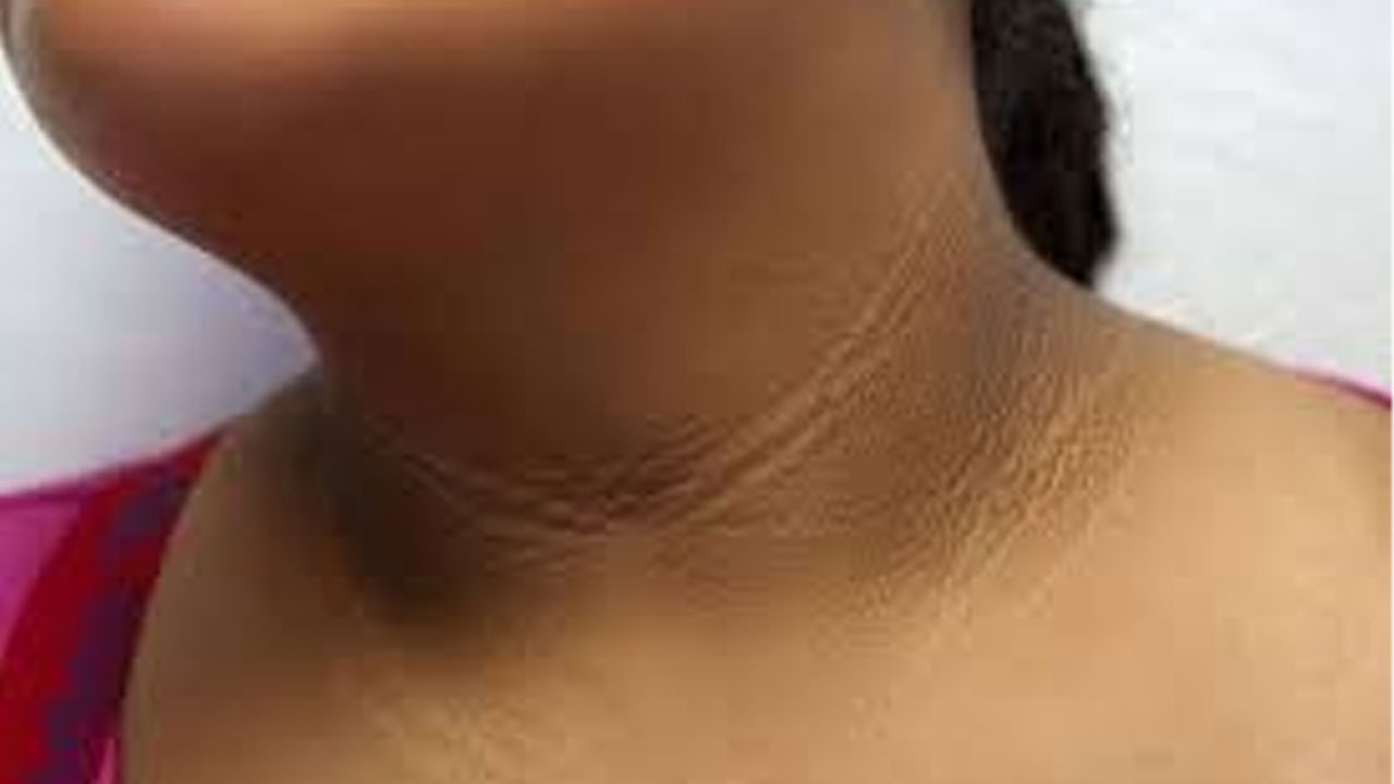 Black Neck